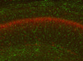 Immunofluorescence of GFAP WT and KO mouse hippocampus with N206B/9 Brain samples courtesy of Albee Messing, UW- Madison.