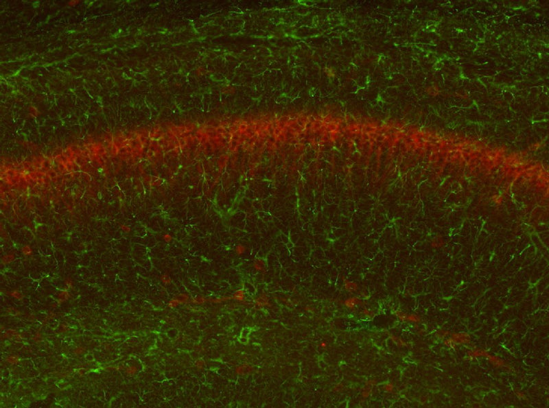 Immunofluorescence of GFAP WT and KO mouse hippocampus with N206B/9  Brain samples courtesy of Albee Messing, UW- Madison.