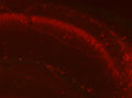 KC rabbit anti- Kv2.1 Brain samples courtesy of Albee Messing, UW- Madison.