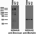 Immunoblot versus crude membrane preparations from adult rat brain (RBM) and Brevican wild-type (WT) and knockout (KO) mice and probed with N294A/6 (left) and N52A/42 (right) TC supe. Mouse brain samples courtesy of Matthew Rasband, Baylor College of Medicine.