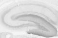 Adult rat hippocampus immunohistochemistry (with antigen retrieval via sodium citrate pretreatment).