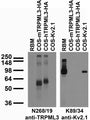 Tissue and transfected cell immunoblot: extracts of rat brain membranes (RBM) and of COS cells transiently transfected with HA-tagged mouse and human TRPML3 (mTRPML3 and hTRPML3) or untagged Kv2.1 plasmid and probed with N268/19 (left) and K89/34 (right) TC supe.