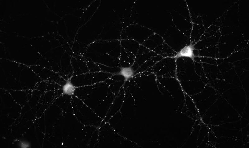 Immunofluorescence staining of 14 DIV cultured rat hippocampal neurons.
