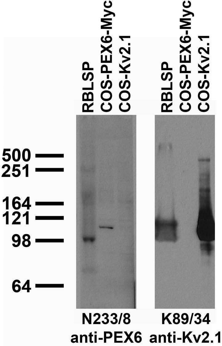 Tissue and transfected cell immunoblot: low speed pellet samples from adult rat brain (RBLSP) and extracts of COS cells transiently transfected with Myc-tagged PEX6 or untagged Kv2.1 plasmids and probed with N233/8 (left) and K89/34 (right).