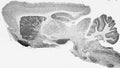 Adult rat brain immunohistochemistry (with antigen retrieval via sodium citrate pretreatment).