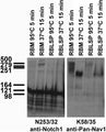 Immunoblot against adult rat brain membrane (RBM) or low- speed pellet (RBLSP) fractions denatured at 95oC for 5 min or 37oC for 15 min and probed with N253/32 (left) and K58/35 (right) TC supe.