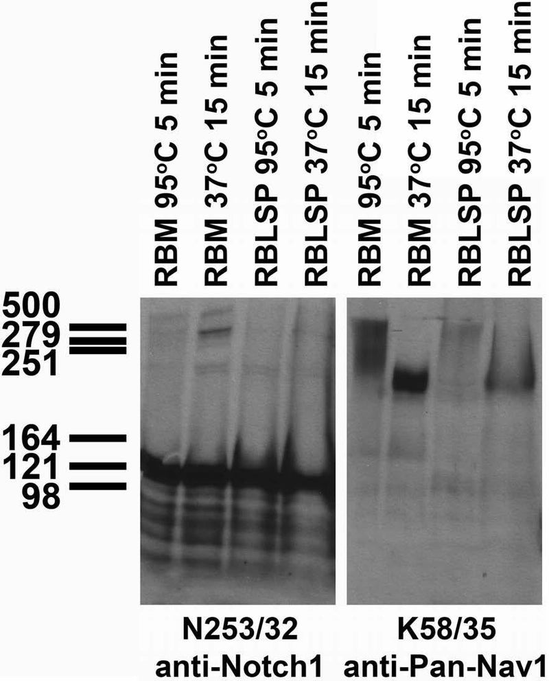 Immunoblot against adult rat brain membrane (RBM) or low- speed pellet (RBLSP) fractions denatured at 95oC for 5 min or 37oC for 15 min and probed with N253/32 (left) and K58/35 (right) TC supe.
