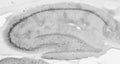 Adult rat hippocampus immunohistochemistry under standard protocol.