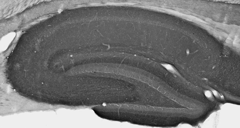 Immunohistochemistry with antigen retrieval via citrate pretreatment.