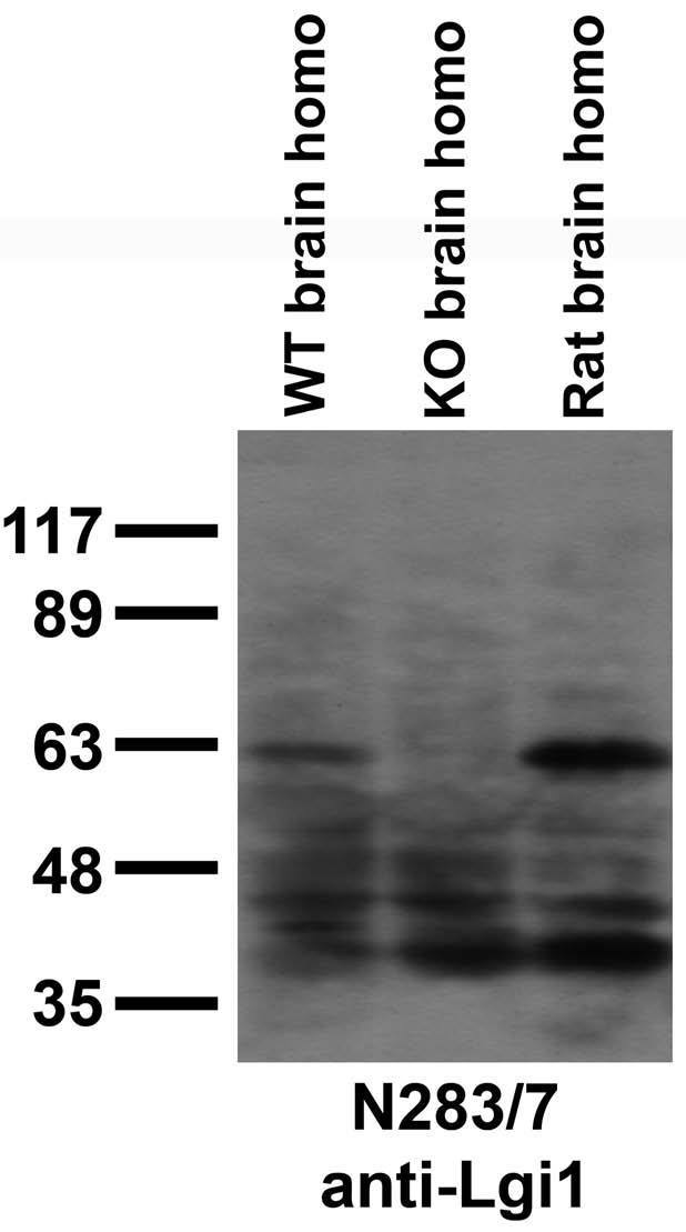 Immunoblot versus whole brain homogenates (homo) from adult rat and WT and Lgi1 KO mouse probed with N283/7 TC supe. Data courtesy of Masaki Fukata (National Institute for Physiological Sciences, Japan).