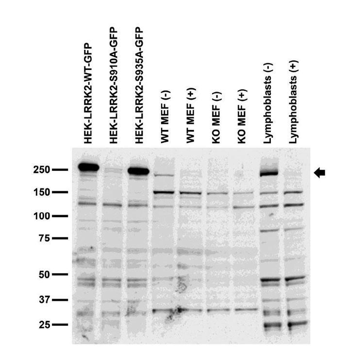 "Endogenous and transfected cell immunoblot: extracts of HEK-293 cells transfected with GFP-tagged LRRK2-WT, LRRK2-S910A or LRRK2-S935A plasmid; fibroblasts from embryonic WT or LRRK2 KO mice untreated or treated with LRRK2-IN-1 inhibitor (2011 Deng et al Nat Chem Biol); and human lymphoblasts untreated or treated with LRRK2-IN-1, probed with 1D8. Data courtesy of Nicolas Dzamko, Paul Davies and Dario Alessi (University of Dundee, Scotland, UK)."