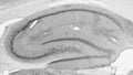 Adult rat hippocampus immunohistochemistry.
