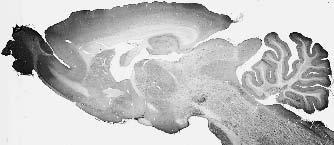 Adult rat brain immunohistochemistry (with antigen retrieval via sodium citrate pretreatment).