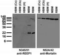 Immunoblot against crude membranes from whole mouse (MBM) or rat (RBM) brain and from human hippocampus [HBM(H)], cerebellum [HBM(Cb)] or cerebral cortex [HBM(Cx)] and probed with N345/51 (left) or N52A/42 (right) TC supe.