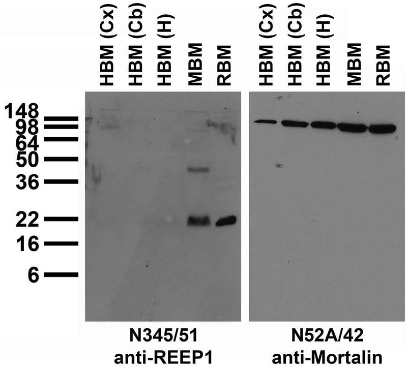 Immunoblot against crude membranes from whole mouse (MBM) or rat (RBM) brain and from human hippocampus [HBM(H)], cerebellum [HBM(Cb)] or cerebral cortex [HBM(Cx)] and probed with N345/51 (left) or N52A/42 (right) TC supe.