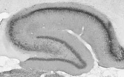 Adult rat hippocampus immunohistochemistry.