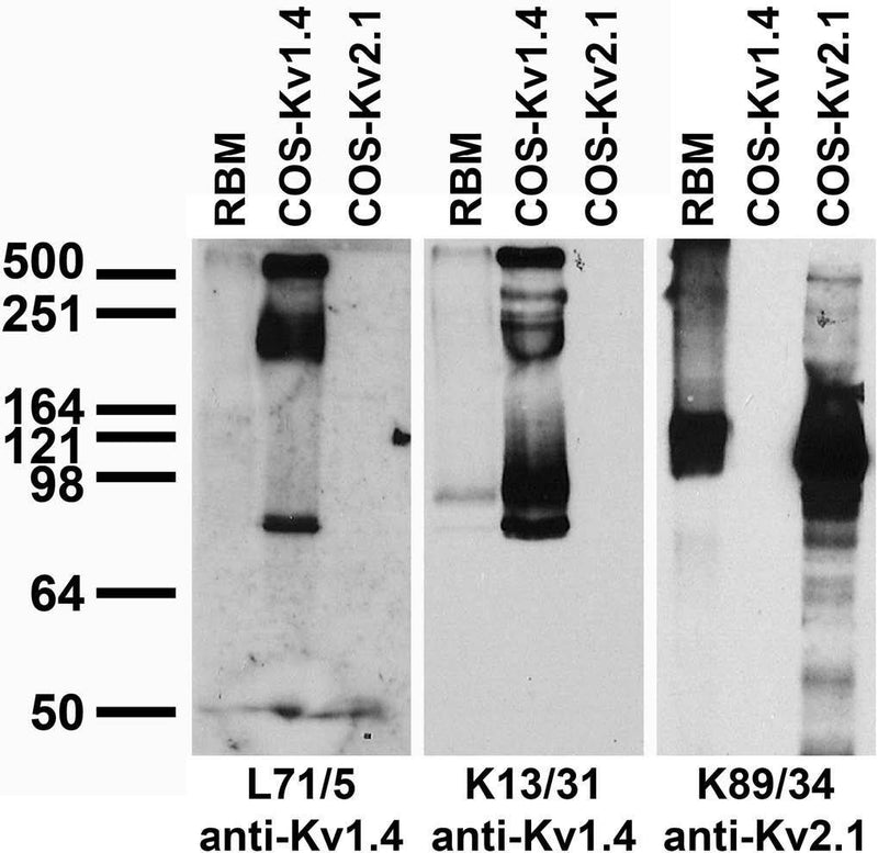 Tissue and transfected cell immunoblot: extracts of crude adult rat brain membrane (RBM) and COS cells transiently transfected with untagged Kv1.4 or Kv2.1 plasmid and probed with L71/5 (left), K13/31 (middle) or K89/34 (right) TC supe.