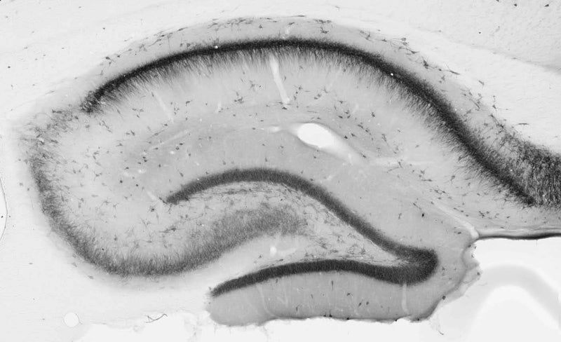 Adult rat hippocampus immunohistochemistry.