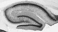 Adult rat hippocampus immunohistochemistry.