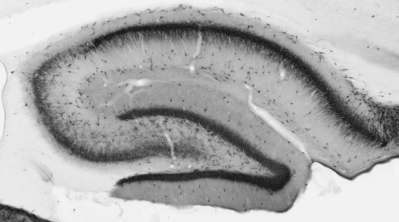 Adult rat hippocampus immunohistochemistry.