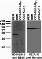 Tissue and transfected cell immunoblot: extracts of rat eye and brain membrane (REM and RBM, respectively) and COS cells transiently transfected with Myc-tagged BBS5 or untagged Kv2.1 plasmid and probed with N304B/115 (left) and N52A/42 (right) TC supe.