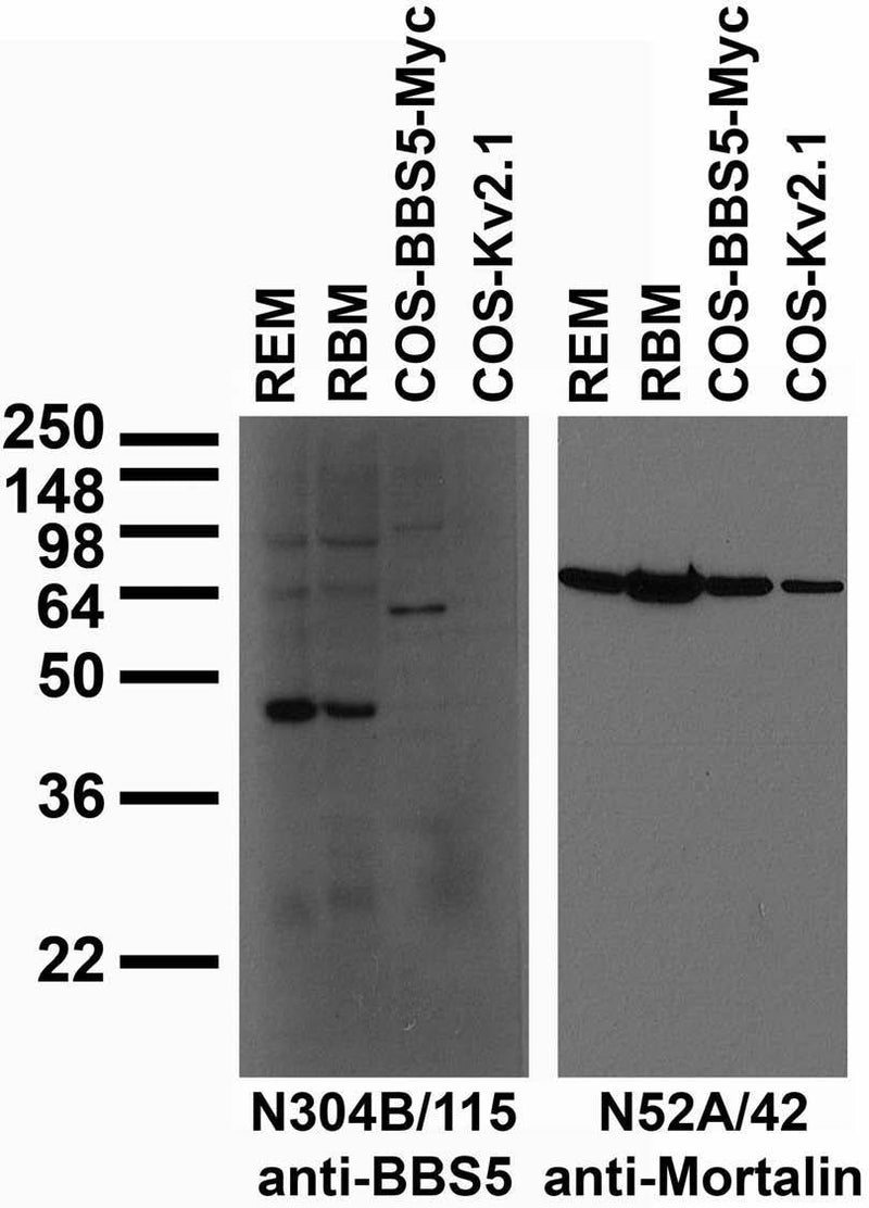 Tissue and transfected cell immunoblot: extracts of rat eye and brain membrane (REM and RBM, respectively) and COS cells transiently transfected with Myc-tagged BBS5 or untagged Kv2.1 plasmid and probed with N304B/115 (left) and N52A/42 (right) TC supe.