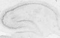 Adult rat hippocampus immunohistochemistry.