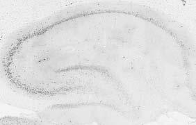 Adult rat hippocampus immunohistochemistry.