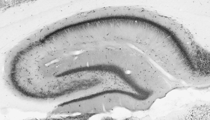Adult rat hippocampus immunohistochemistry.