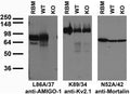 Immunoblot versus crude membranes from adult rat brain (RBM) and lysates of WT and AMIGO-1 KO mouse brains probed with L86A/37 (left), K89/34 (middle) and N52A/42 (right) TC supe. Mouse brain samples courtesy of Juha Kuja-Panula (University of Helsinki, Finland).