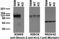 Immunoblot versus crude membranes from adult rat brain (RBM) and WT and Stonin-2 KO mouse brains probed with N346/9 (left), K89/34 (middle) and N52A/42 (right) TC supes. Mouse brains courtesy of Fabian Feutlinske and Volker Haucke (Freie Universität Berlin).