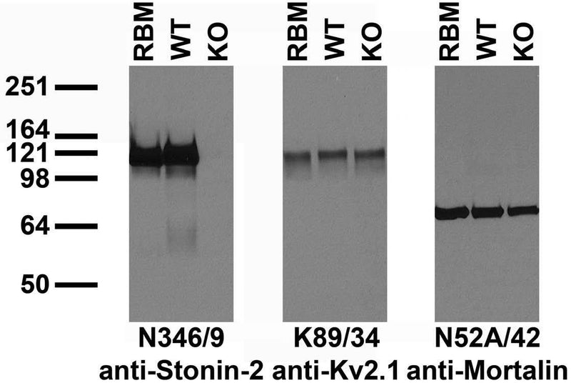 Immunoblot versus crude membranes from adult rat brain (RBM) and WT and Stonin-2 KO mouse brains probed with N346/9 (left), K89/34 (middle) and N52A/42 (right) TC supes. Mouse brains courtesy of Fabian Feutlinske and Volker Haucke (Freie Universität Berlin).