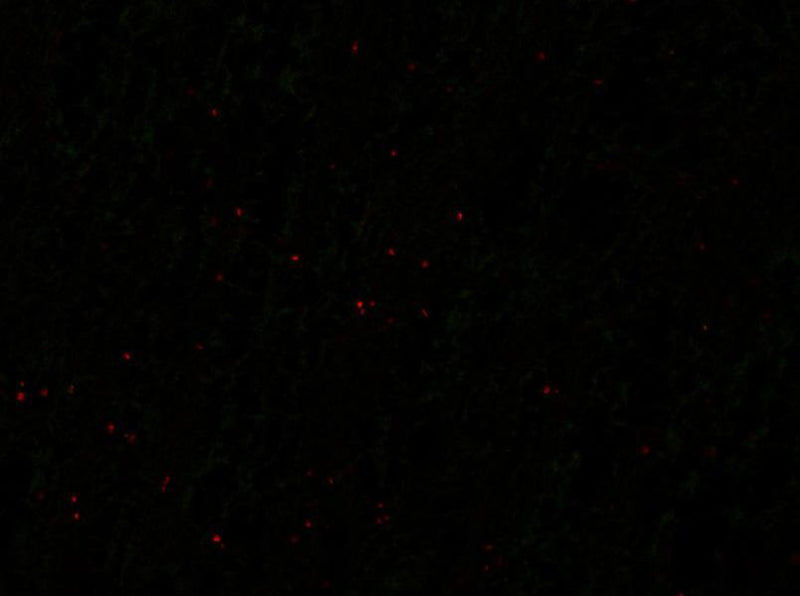 Knockout (KO) mice with N364/10 (green) and bIV- spectrin rabbit polyclonal (red). Images courtesy of Kae-Jiun Chang and Matt Rasband (Baylor College of Medicine).
