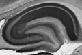 Adult rat hippocampus immunohistochemistry.