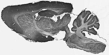 Adult rat brain immunohistochemistry.