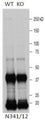 Immunoblot versus LRRK1-immunoprecipitated extracts from WT and LRRK1 KO mouse heart probed with N341/12 TC supe. Data courtesy of Paul Davies and Dario Alessi (University of Dundee, Scotland, UK.