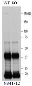 Immunoblot versus LRRK1-immunoprecipitated extracts from WT and LRRK1 KO mouse heart probed with N341/12 TC supe. Data courtesy of Paul Davies and Dario Alessi (University of Dundee, Scotland, UK.
