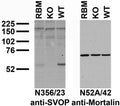 Immunoblot against adult rat brain membranes (RBM) and membranes from SVOP knockout (KO) and wild-type (WT) mice probed with N356/23 (left) and N52A/42 (right) TC supe. Mouse brains courtesy of Jia Yao and Sandra Bajjalieh (University of Washington.