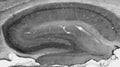 Whole brain immunohistochemistry.