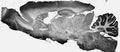 Adult rat hippocampus immunohistochemistry.