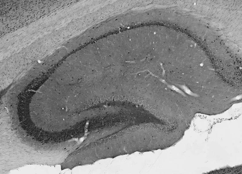Adult rat hippocampus immunohistochemistry.