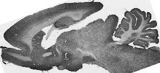adult rat Whole brain immunohistochemistry.