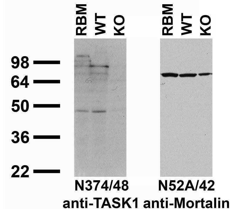 Immunoblot versus crude membranes from adult rat brain (RBM) and wild-type (WT) and TASK1 KO mouse brains probed with N374/48 (left) and N52A/42 (right) TC supe. Mouse brains courtesy of Doug Bayliss (University of Virginia).