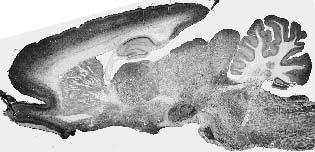 Adult rat brain immunohistochemistry.