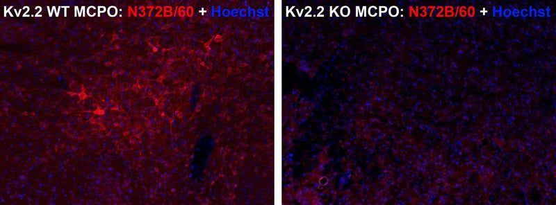 Immunofluorescence staining of adult wild-type (WT) and Kv2.2 knockout (KO) mouse magnocellular preoptic nucleus (MCPO) with N372B/60 (red) and Hoechst nuclear stain (blue.