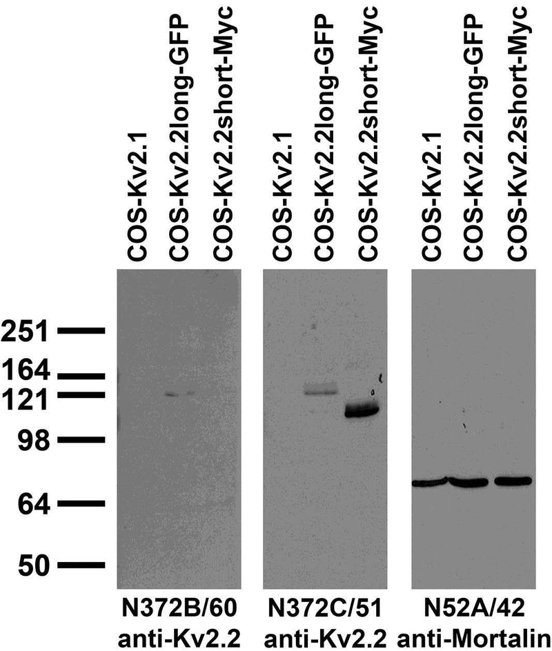 Immunoblot against extracts of COS cells transiently transfected with GFP-tagged Kv2.2long, Myc-tagged Kv2.2short or untagged Kv2.1 plasmid probed with N372B/60 (left), N372C/51 (middle) or N52A/42 (right) TC supe.