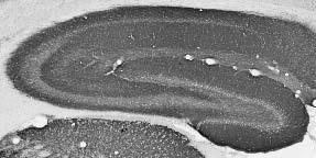 Adult rat hippocampus immunohistochemistry.