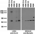 Immunoblot against crude membrane fractions from whole mouse (MBM) or rat (RBM) brain and from human hippocampus [HBM(H)], cerebellum [HBM(Cb)] or cerebral cortex [HBM(Cx)] and probed with L28/4 (left) or N52A/42 (right) TC supe.