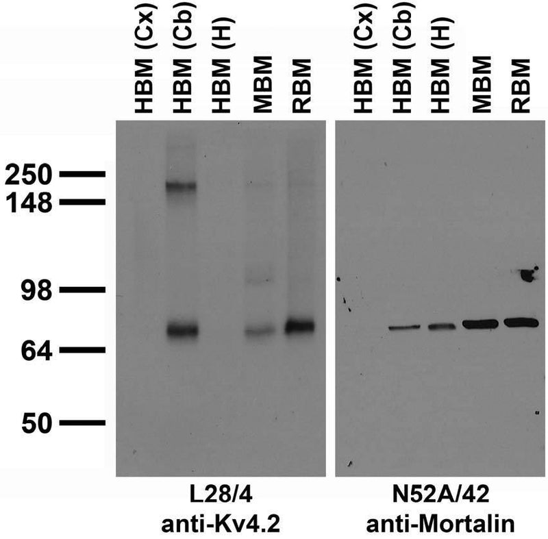 Immunoblot against crude membrane fractions from whole mouse (MBM) or rat (RBM) brain and from human hippocampus [HBM(H)], cerebellum [HBM(Cb)] or cerebral cortex [HBM(Cx)] and probed with L28/4 (left) or N52A/42 (right) TC supe.