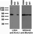 Immunoblot against crude brain membranes from adult rat (RBM) and wild-type (WT) and Kv4.2 knockout (KO) mice probed with L28/4 (left) or N52A/42 (right) TC supe.
